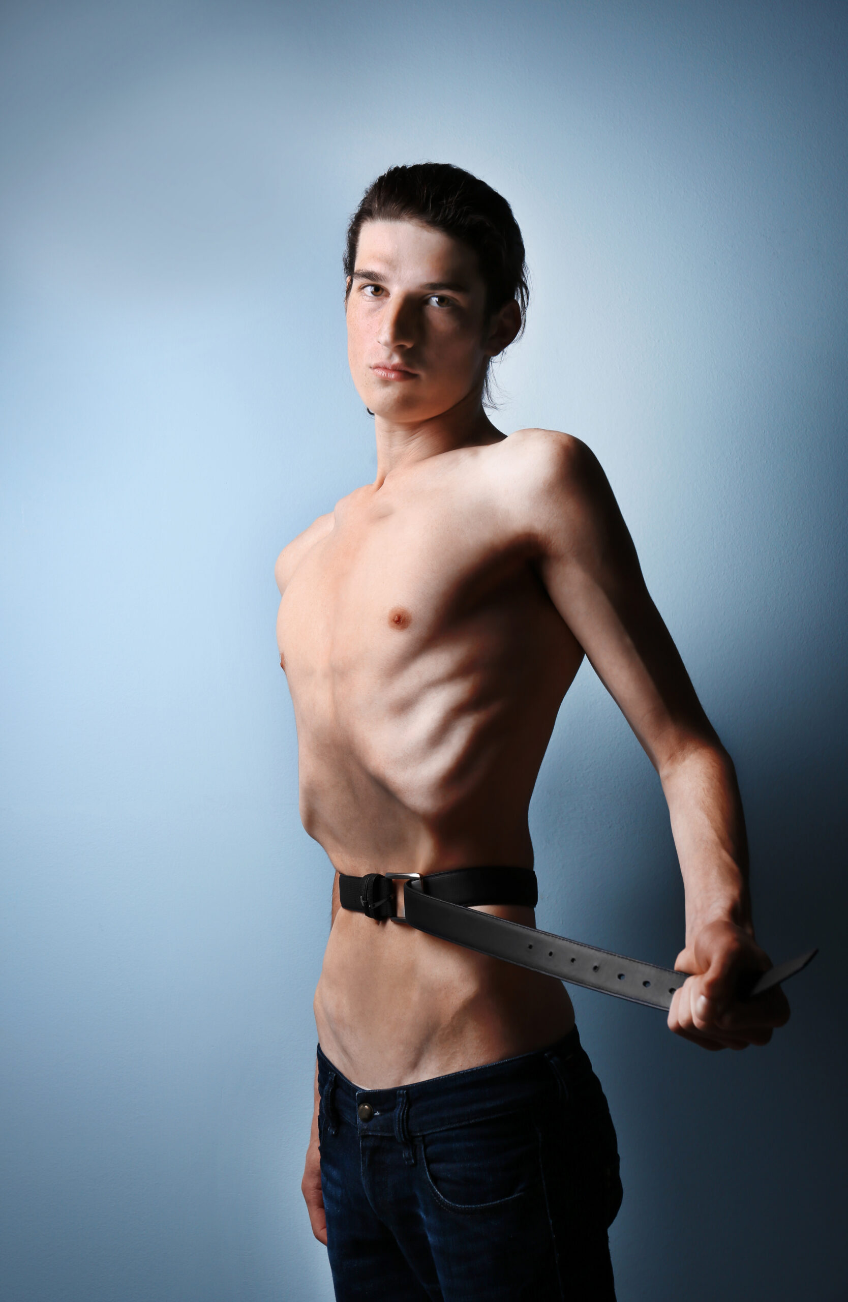 Man with eating disorder